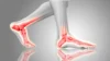 Foot Massagers for Plantar Fasciitis
