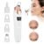Pore Vacuum Cleaner – Electric Vacuum Pore Remover for Blackheads, Acne & Deep Facial Cleaning