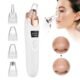 Pore Vacuum Cleaner – Electric Vacuum Pore Remover for Blackheads, Acne & Deep Facial Cleaning